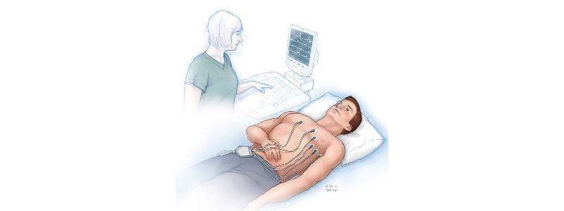 ECG Test in Goregaon