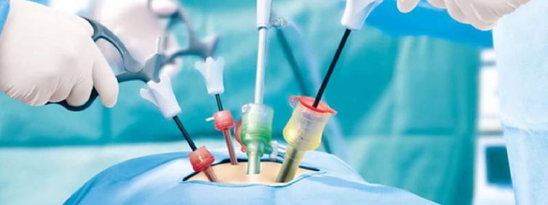 Laparoscopic Surgeon in Goregaon